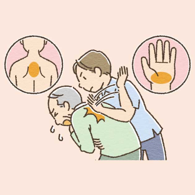 背部叩打法（はいぶこうだほう）のイラスト